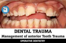 Dental Trauma